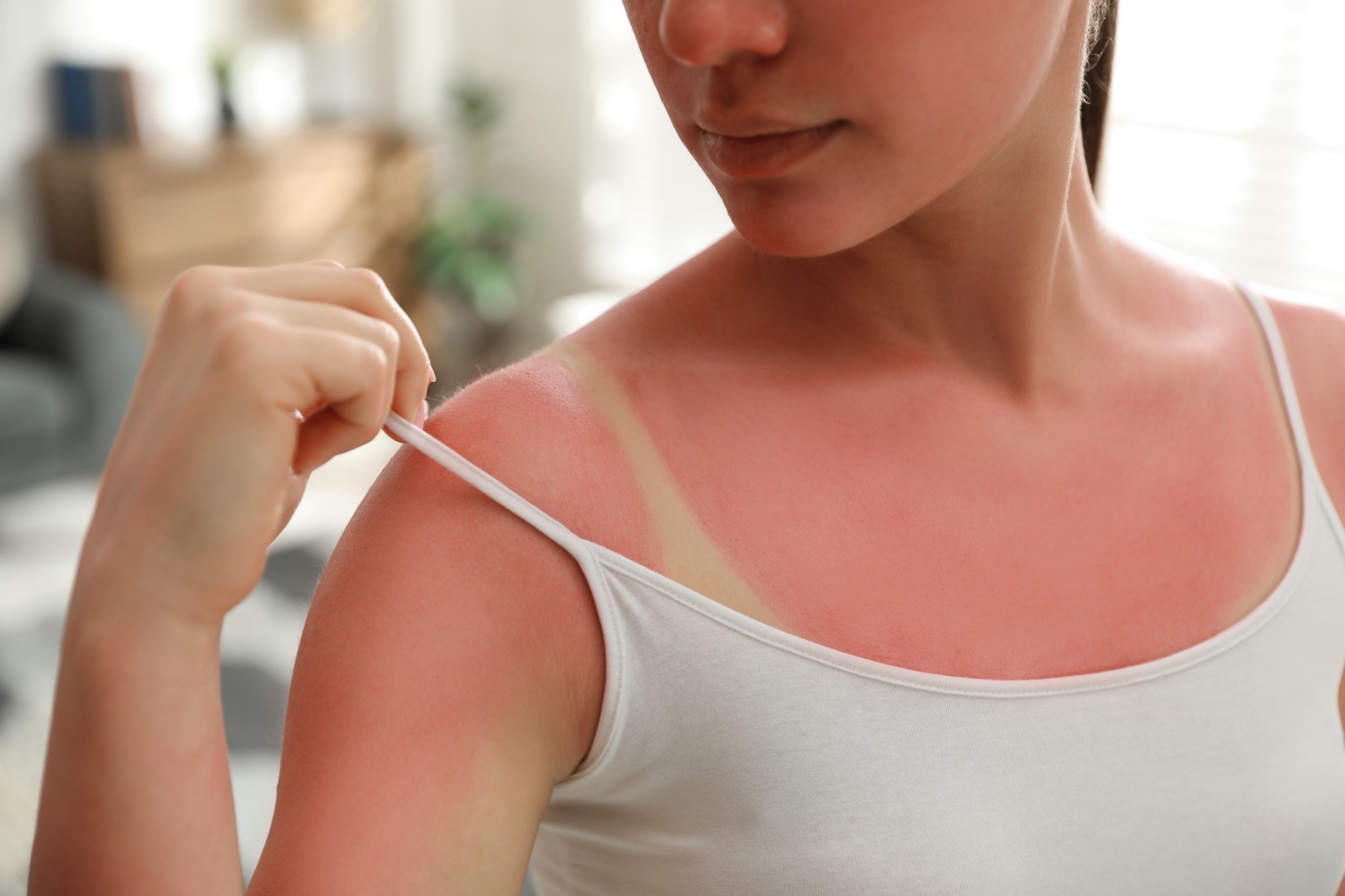 A closeup of a woman lifting her tank top strap to check her sunburn.