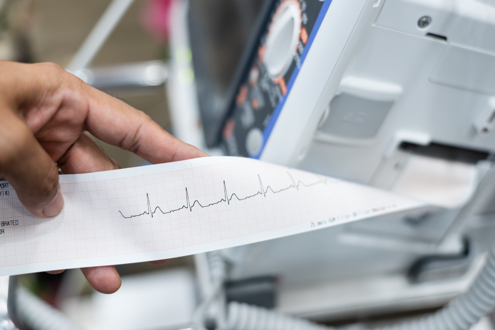 A closeup image of a doctor holding a printout with readings from an EKG machine.